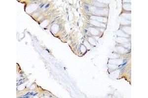 Immunohistochemistry of paraffin-embedded Human colon using LRG1 Polyclonal Antibody at dilution of 1:100 (40x lens). (LRG1 抗体)