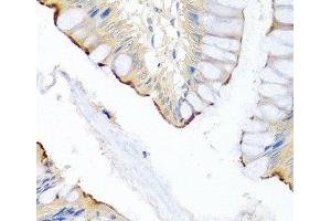 Immunohistochemistry of paraffin-embedded Human colon using LRG1 Polyclonal Antibody at dilution of 1:100 (40x lens).