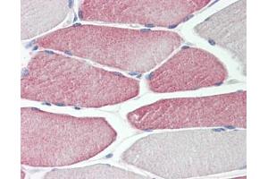 Image no. 1 for anti-Cytochrome P450, Family 2, Subfamily D, Polypeptide 6 (CYP2D6) (AA 268-457) antibody (ABIN467616)