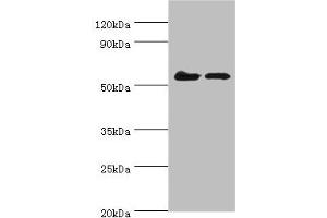 Western blot All lanes: CDK16 antibody at 5 μg/mL Lane 1: Mouse brain tissue Lane 2: Mouse small intestineSecondary Goat polyclonal to rabbit IgG at 1/10000 dilution Predicted band size: 56, 64, 57 kDa Observed band size: 56 kDa (CDK16 抗体  (AA 277-496))