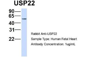Host: Rabbit   Target Name: USP22   Sample Tissue: Human Fetal Heart  Antibody Dilution: 1. (USP22 抗体  (Middle Region))