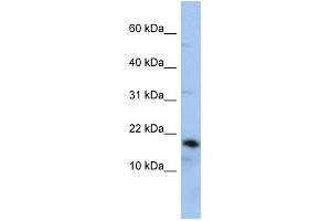 WB Suggested Anti-LCN1 Antibody Titration: 0. (Lipocalin 1 抗体  (Middle Region))