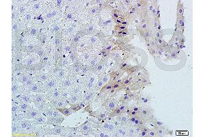Immunohistochemistry (IHC) image for anti-Tumor Necrosis Factor (Ligand) Superfamily, Member 14 (TNFSF14) (AA 141-240) antibody (ABIN740625)