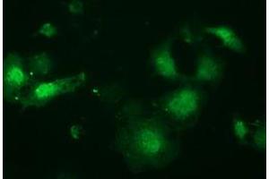 Anti-LIN7B mouse monoclonal antibody (ABIN2453853) immunofluorescent staining of COS7 cells transiently transfected by pCMV6-ENTRY LIN7B (RC205598). (LIN7B 抗体)