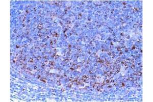 Immunohistochemistry (IHC) image for anti-Checkpoint Kinase 1 (CHEK1) antibody (ABIN487487) (CHEK1 抗体)