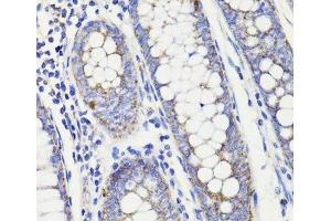 Immunohistochemistry of paraffin-embedded Human colon using PDCD10 Polyclonal Antibody at dilution of 1:100 (40x lens). (PDCD10 抗体)