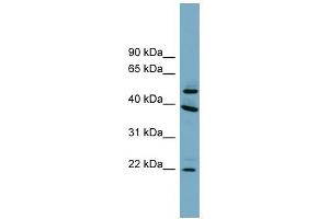 C4ORF20 antibody used at 1 ug/ml to detect target protein. (UFSP2 抗体  (Middle Region))