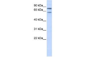 Western Blotting (WB) image for anti-Potassium Voltage-Gated Channel, KQT-Like Subfamily, Member 1 (KCNQ1) (N-Term) antibody (ABIN2776085)