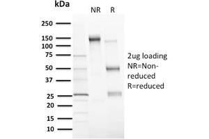 SDS-PAGE Analysis Purified MDM2 Mouse Monoclonal Antibody (MDM2/2414). (MDM2 抗体  (AA 126-254))