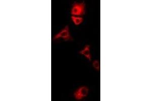 Immunofluorescent analysis of E3BP staining in U2OS cells. (PDHX 抗体)
