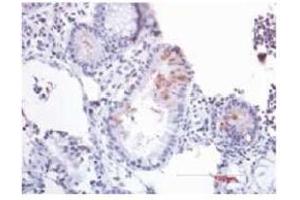 Immunohistochemistry (IHC) image for anti-Defensin beta 2 (BD-2) (AA 4-41) antibody (ABIN191997) (beta 2 Defensin 抗体  (AA 4-41))