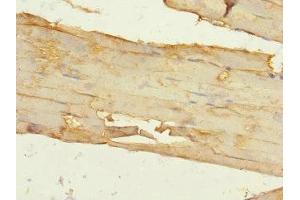Immunohistochemistry of paraffin-embedded human skeletal muscle tissue using ABIN7156429 at dilution of 1:100 (ITGA11 抗体  (AA 940-1141))
