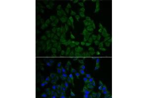 Immunofluorescence analysis of HeLa cells using NF2 Polyclonal Antibody (Merlin 抗体)