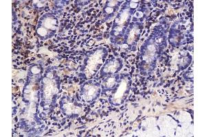 anti-TGF beta 3 Propeptide (AA 41-90) antibody