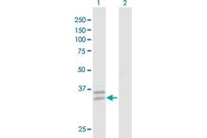 Western Blot analysis of PPT2 expression in transfected 293T cell line by PPT2 MaxPab polyclonal antibody. (PPT2 抗体  (AA 1-302))