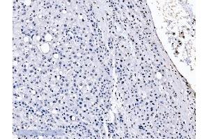 IHC analysis of splicing factor 1 using anti-splicing factor 1 antibody (ABIN7600193). (Splicing Factor 1 抗体  (AA 160-266))