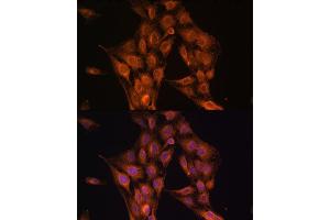 Immunofluorescence analysis of C6 cells using NF2 antibody (ABIN6128275, ABIN6144548, ABIN6144551 and ABIN7101344) at dilution of 1:100. (Merlin 抗体  (AA 477-576))