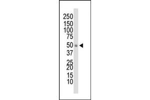 Western blot analysis of anti-DOK1 Pab (ABIN392070 and ABIN2841833) in HL-60 cell lysate.