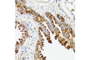 Immunohistochemistry (IHC) image for anti-Protein tyrosine Phosphatase Type IVA, Member 2 (PTP4A2) (AA 30-100) antibody (ABIN7269703)