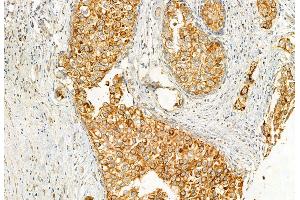 ABIN6262304 and ABIN6272944 at 1/100 staining Human normal tissues adjacent to lung cancer by IHC-P. (HMGCS1 抗体  (Internal Region))