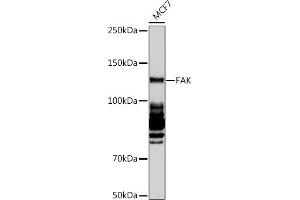 Western blot analysis of extracts of MCF7 cells, using FAK pAb (ABIN6131637, ABIN6135867, ABIN6135868 and ABIN7101374) at 1:1000 dilution. (FAK 抗体)