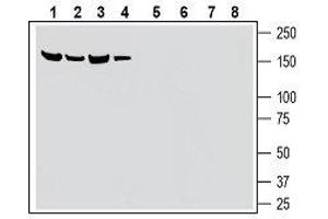 Western blot analysis of mouse kidney membranes (lanes 1 and 5), rat pancreas lysates (lanes 2 and 6), mouse brain membranes (lanes 3 and 7) and rat brain lysate (lanes 4 and 8): - 1-4. (SLC28A3 抗体  (5th Extracellular Loop))
