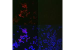 Immunofluorescence analysis of 293T cells using MLC3B Mouse mAb (ABIN7268520) at dilution of 1:100 (40x lens). (LC3B 抗体)