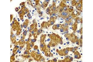 Immunohistochemistry of paraffin-embedded Human liver damage using SMAD9 Polyclonal Antibody at dilution of 1:100 (40x lens). (SMAD9 抗体)