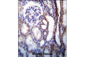 ATP6V1B1 Antibody immunohistochemistry analysis in formalin fixed and paraffin embedded human kidney tissue followed by peroxidase conjugation of the secondary antibody and DAB staining.