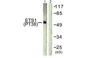 Western Blotting (WB) image for anti-V-Ets erythroblastosis Virus E26 Oncogene Homolog 1 (Avian) (ETS1) (AA 11-60), (pThr38) antibody (ABIN1531315)