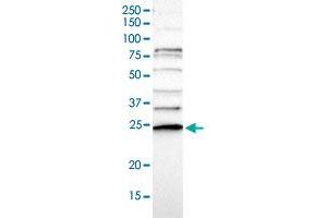 Western blot analysis of Human cell line RT-4 with CD34 polyclonal antibody  at 1:100-1:250 dilution. (CDC34 抗体)