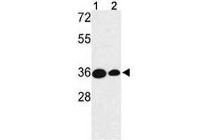 Western blot analysis of TAZ antibody and (1) MDA-MB231 and (2) NCI-H460 lysate. (TAZ 抗体  (AA 32-60))