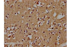 IHC image of ABIN7139735 diluted at 1:100 and staining in paraffin-embedded human brain tissue performed on a Leica BondTM system. (AXIN2 抗体  (AA 56-73))