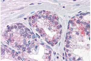 Human Prostate (formalin-fixed, paraffin-embedded) stained with PDE11A antibody ABIN337393 at 10 ug/ml followed by biotinylated anti-goat IgG secondary antibody ABIN481715, alkaline phosphatase-streptavidin and chromogen. (PDE11A 抗体  (AA 455-468))
