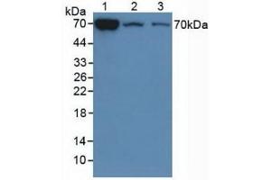 Detection of CHI3L1 in Mouse Liver Tissue, 2: Mouse Lung Tissue,3:Mouse Spleen Tissue using Polyclonal Antibody to Chitinase-3-like Protein 1 (CHI3L1) (CHI3L1 抗体  (AA 112-356))