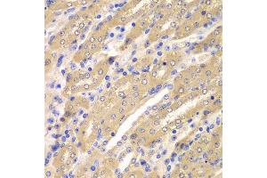 Immunohistochemistry of paraffin-embedded mouse kidney using ERGIC2 antibody at dilution of 1:100 (x400 lens). (ERGIC2 抗体)