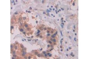 Immunohistochemistry (IHC) image for anti-Sema Domain, Immunoglobulin Domain (Ig), Short Basic Domain, Secreted, (Semaphorin) 3F (SEMA3F) (AA 350-483) antibody (ABIN1860521)