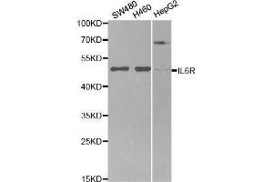 Western blot analysis of extracts of various cell lines, using IL6R antibody. (IL-6 Receptor 抗体  (AA 20-320))