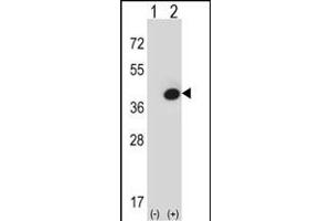 Western blot analysis of FBP1 (arrow) using rabbit polyclonal FBP1 Antibody (Center) (ABIN391577 and ABIN2841512). (FBP1 抗体  (AA 125-156))
