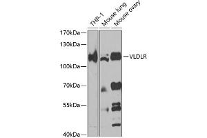 Western blot analysis of extracts of various cell lines, using VLDLR antibody (ABIN7271310) at 1:1000 dilution. (VLDLR 抗体  (AA 20-210))