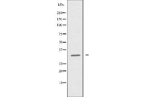 Western blot analysis of extracts from HeLa cells using Cytochrome c-type Heme Lyase antibody. (HCCS 抗体  (Internal Region))