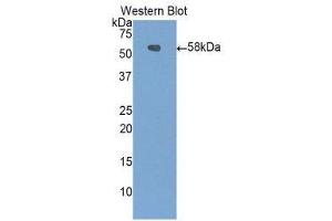 Western Blotting (WB) image for anti-Carboxypeptidase N Subunit 1 (CPN1) (AA 221-449) antibody (ABIN1858481) (CPN1 抗体  (AA 221-449))