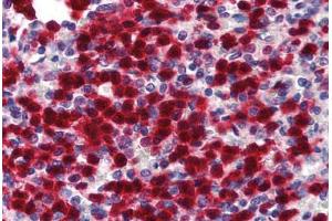 Human Spleen (formalin-fixed, paraffin-embedded) stained with CDA antibody ABIN293380 at 5 ug/ml followed by biotinylated goat anti-rabbit IgG secondary antibody ABIN481713, alkaline phosphatase-streptavidin and chromogen. (CDA 抗体  (N-Term))