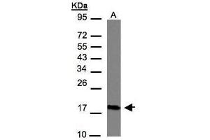 WB Image Sample(30 μg of whole cell lysate) A:Hep G2, 12% SDS PAGE antibody diluted at 1:1000 (CMTM6 抗体  (C-Term))