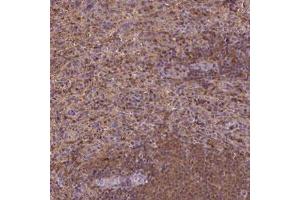 Immunohistochemical staining (Formalin-fixed paraffin-embedded sections) of human spleen with MATK polyclonal antibody  shows strong positivity in cells in red pulp. (MATK 抗体)