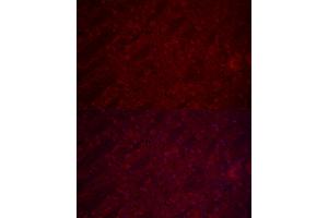 Immunofluorescence analysis of mouse brain cells using SLC17 Rabbit pAb (ABIN6127303, ABIN6147863, ABIN6147864 and ABIN6216671) at dilution of 1:250 (40x lens).