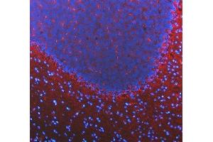 IF analysis of SLC6A1 using anti-SLC6A1 antibody (ABIN5518957).