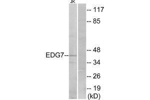 Western blot analysis of extracts from Jurkat cells, using EDG7 antibody. (LPAR3 抗体  (Internal Region))
