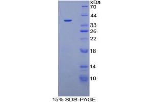 SDS-PAGE analysis of Human Plasminogen Protein. (PLG 蛋白)