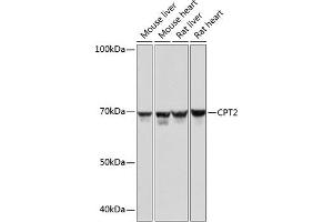 Western blot analysis of extracts of various cell lines, using CPT2 Rabbit mAb (ABIN7266090) at 1:1000 dilution. (CPT2 抗体)